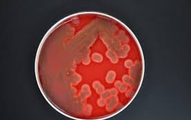 Nébih: baktérium okozta a kondorosi megbetegedéseket