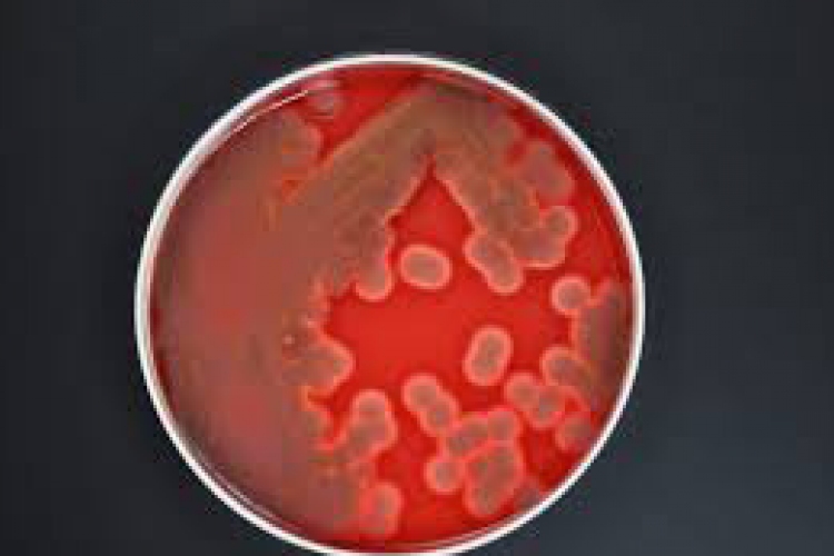 Nébih: baktérium okozta a kondorosi megbetegedéseket